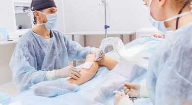 chirurgie pro křečové žíly