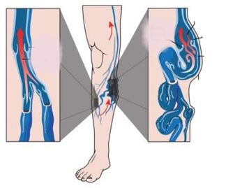 Příčiny, příznaky